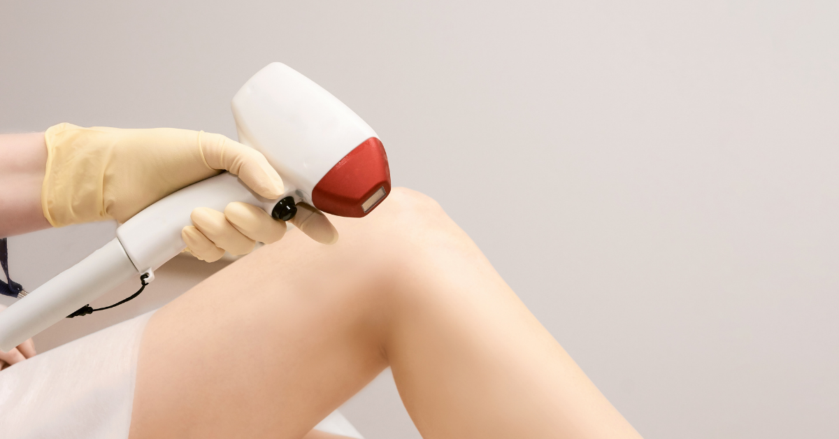 Top 12 Benefits of Laser Hair Removal